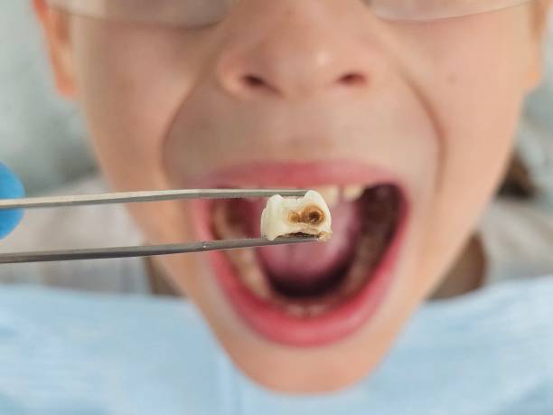 Best Weekend Emergency Dentist in Eldon, MO